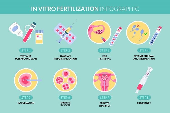 In Vitro Fertilization (IVF)