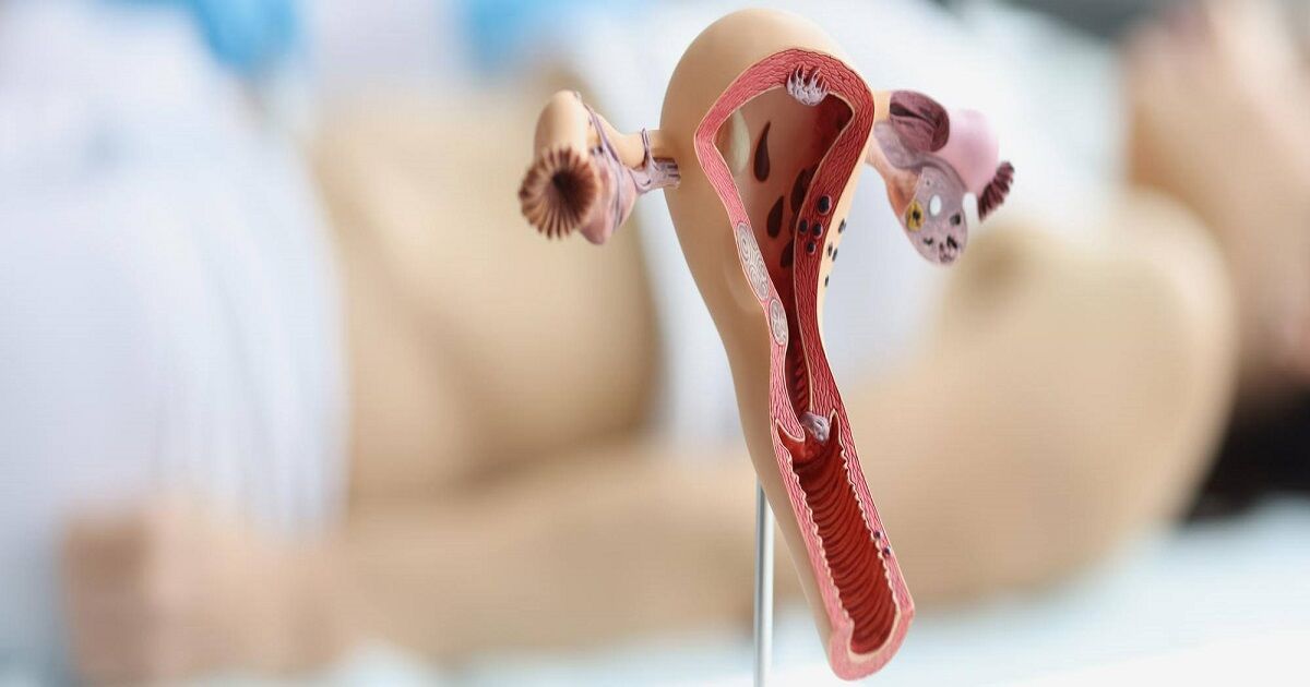 Normal Ovary Size | Normal Ovary Size in mm | Normal Ovary Size in cm